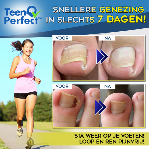 TeenPerfect™ - Nooit meer last van ingegroeide nagels!