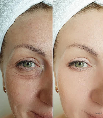 BrightEye® | Anti Aging & Wrinkle Removing Eye Cream